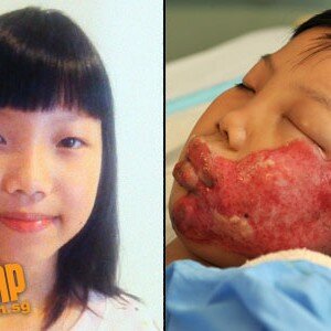 Singapore girl burnt by metal sheet Misc